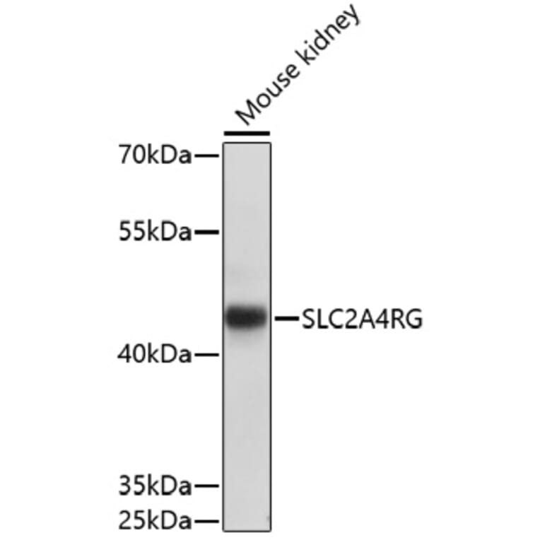 Western Blot - Anti-SLC2A4RG Antibody (A91759) - Antibodies.com