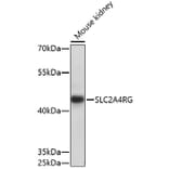 Western Blot - Anti-SLC2A4RG Antibody (A91759) - Antibodies.com