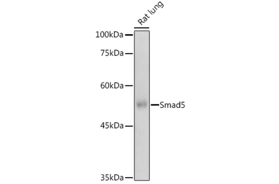 Western Blot - Anti-SMAD5 Antibody (A91760) - Antibodies.com