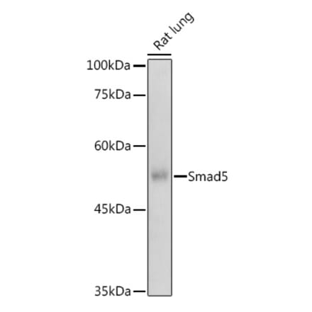 Western Blot - Anti-SMAD5 Antibody (A91760) - Antibodies.com