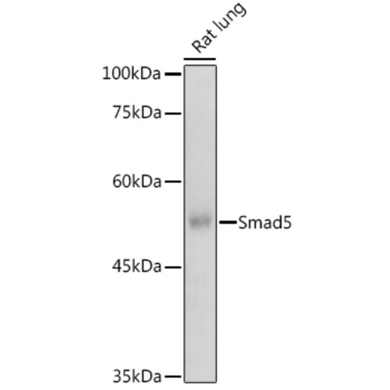 Western Blot - Anti-SMAD5 Antibody (A91760) - Antibodies.com