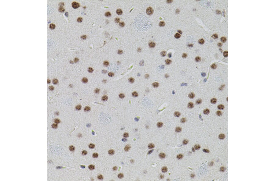 Immunohistochemistry - Anti-SMAD5 Antibody (A91760) - Antibodies.com