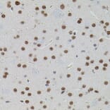 Immunohistochemistry - Anti-SMAD5 Antibody (A91760) - Antibodies.com