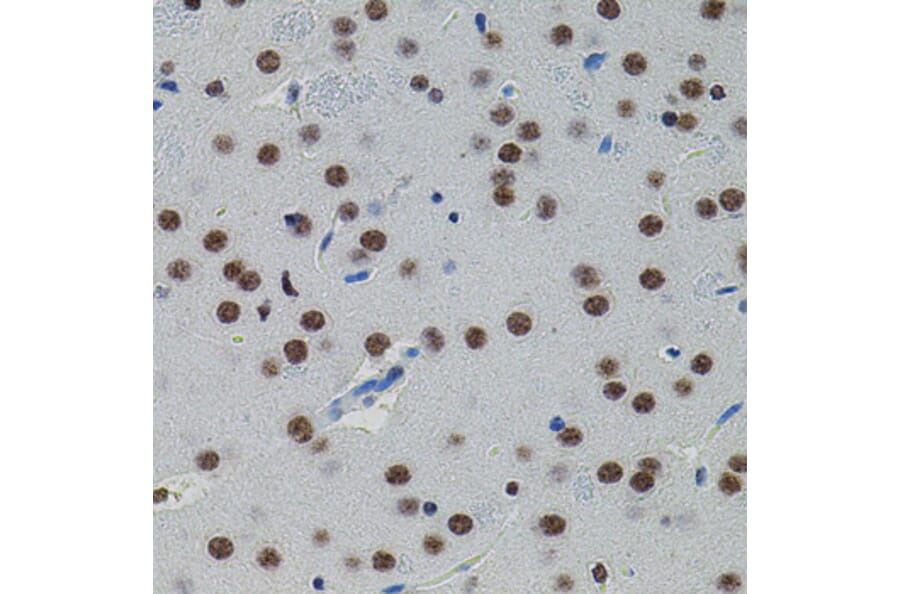 Immunohistochemistry - Anti-SMAD5 Antibody (A91760) - Antibodies.com