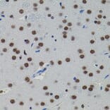 Immunohistochemistry - Anti-SMAD5 Antibody (A91760) - Antibodies.com