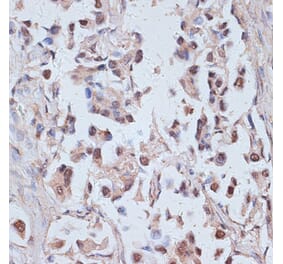 Immunohistochemistry - Anti-TAX1BP1 Antibody (A91761) - Antibodies.com