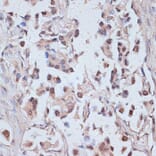 Immunohistochemistry - Anti-TAX1BP1 Antibody (A91761) - Antibodies.com
