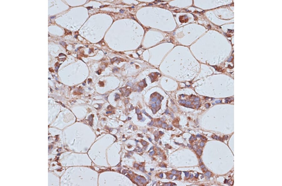 Immunohistochemistry - Anti-TAX1BP1 Antibody (A91761) - Antibodies.com