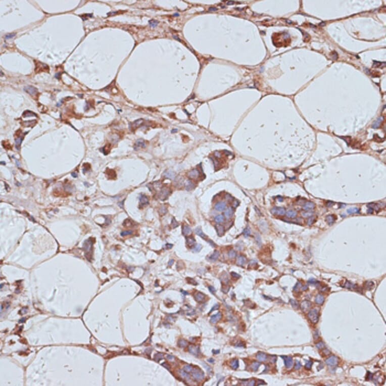 Immunohistochemistry - Anti-TAX1BP1 Antibody (A91761) - Antibodies.com