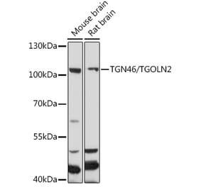 Western Blot - Anti-TGN46 Antibody (A91762) - Antibodies.com