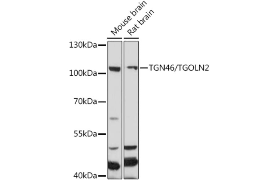 Western Blot - Anti-TGN46 Antibody (A91762) - Antibodies.com