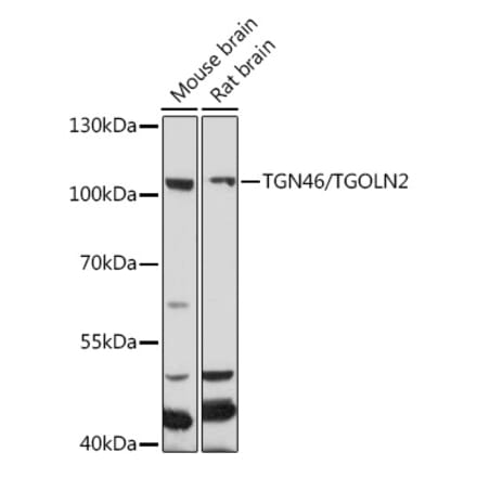 Western Blot - Anti-TGN46 Antibody (A91762) - Antibodies.com