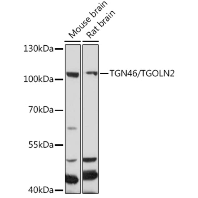 Western Blot - Anti-TGN46 Antibody (A91762) - Antibodies.com