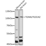 Western Blot - Anti-TGN46 Antibody (A91762) - Antibodies.com