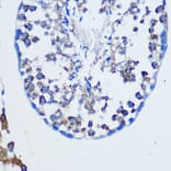 Immunohistochemistry - Anti-TGN46 Antibody (A91762) - Antibodies.com