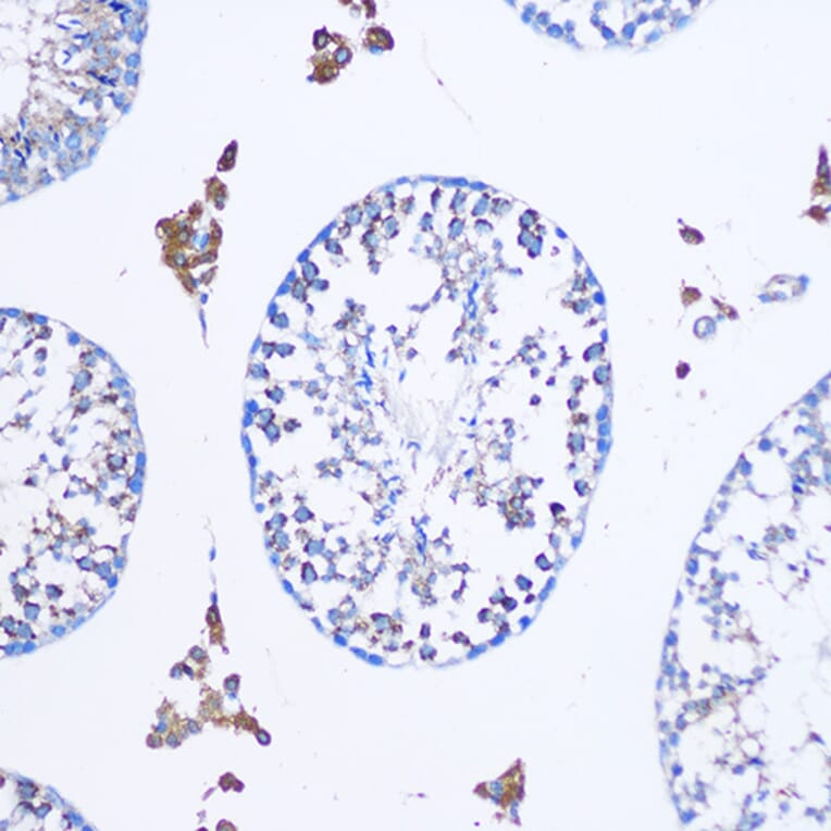 Immunohistochemistry - Anti-TGN46 Antibody (A91762) - Antibodies.com