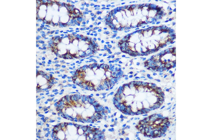 Immunohistochemistry - Anti-TGN46 Antibody (A91762) - Antibodies.com