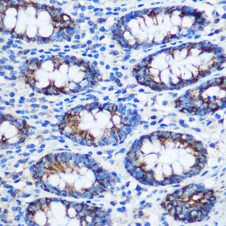 Immunohistochemistry - Anti-TGN46 Antibody (A91762) - Antibodies.com