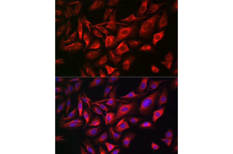 Immunofluorescence - Anti-TGN46 Antibody (A91762) - Antibodies.com