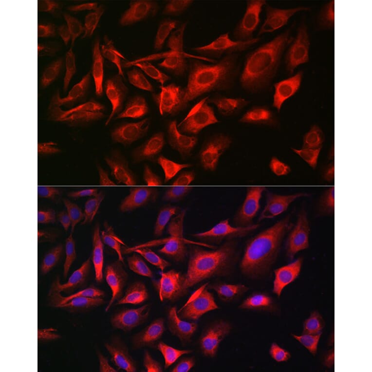 Immunofluorescence - Anti-TGN46 Antibody (A91762) - Antibodies.com