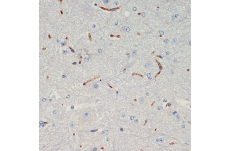 Immunohistochemistry - Anti-Thrombospondin 1 Antibody (A91763) - Antibodies.com