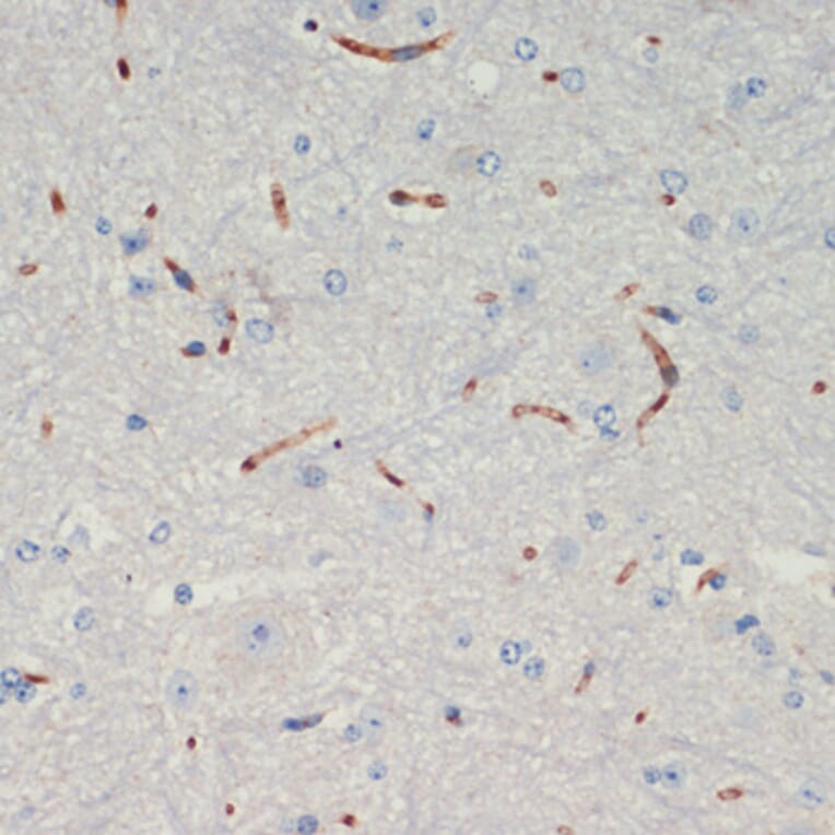 Immunohistochemistry - Anti-Thrombospondin 1 Antibody (A91763) - Antibodies.com