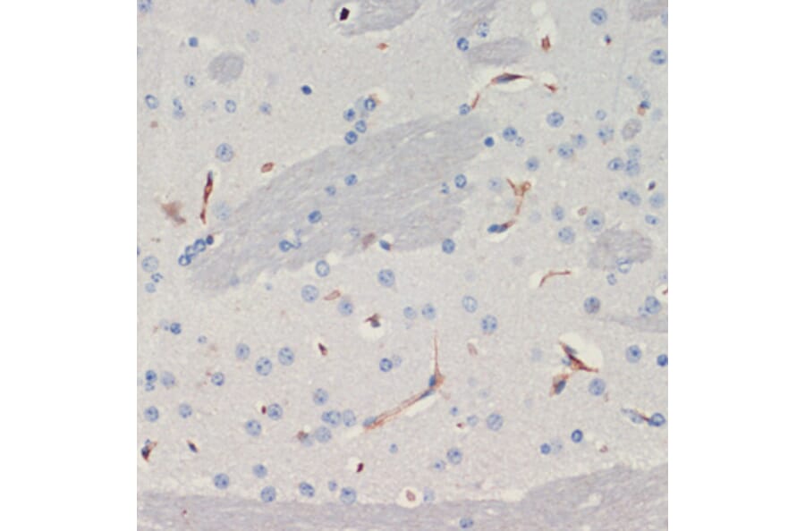 Immunohistochemistry - Anti-Thrombospondin 1 Antibody (A91763) - Antibodies.com