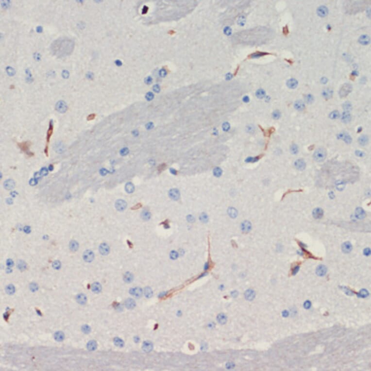 Immunohistochemistry - Anti-Thrombospondin 1 Antibody (A91763) - Antibodies.com