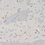 Immunohistochemistry - Anti-Thrombospondin 1 Antibody (A91763) - Antibodies.com