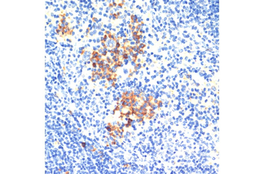 Immunohistochemistry - Anti-Thrombospondin 1 Antibody (A91763) - Antibodies.com