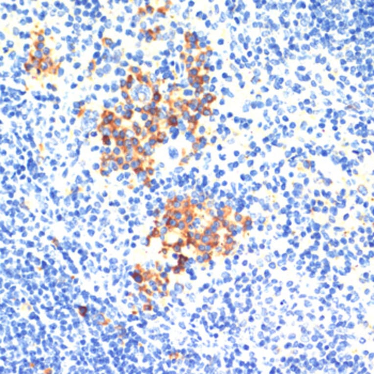 Immunohistochemistry - Anti-Thrombospondin 1 Antibody (A91763) - Antibodies.com