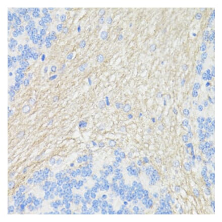 Immunohistochemistry - Anti-CD90 / Thy1 Antibody (A91764) - Antibodies.com