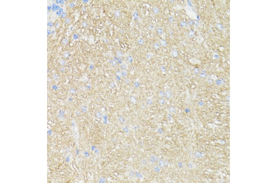 Immunohistochemistry - Anti-CD90/Thy1 Antibody (A91764) - Antibodies.com