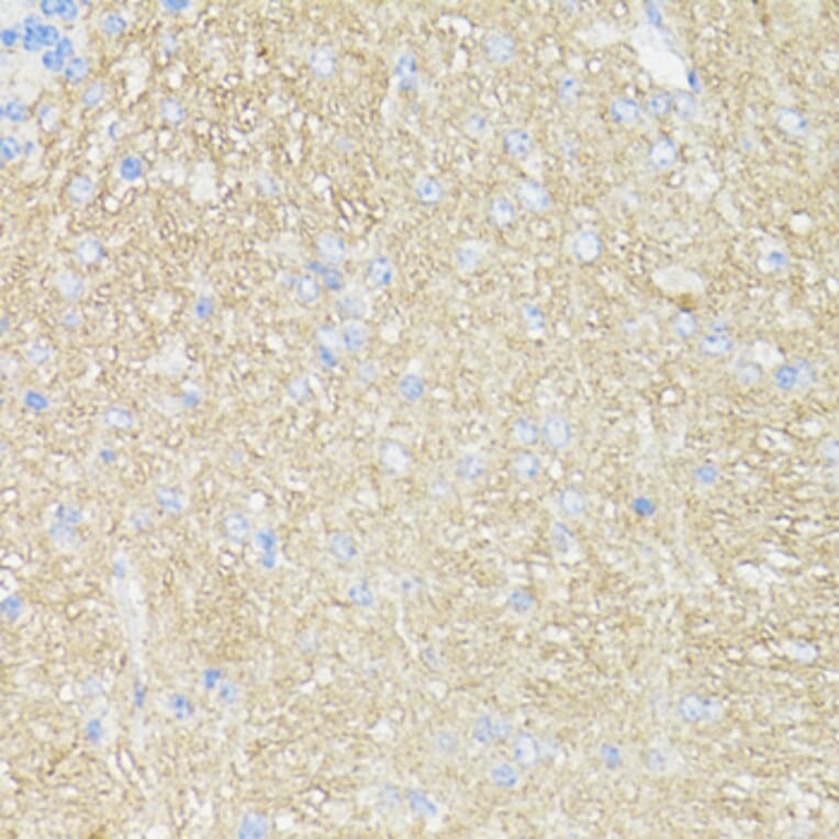 Immunohistochemistry - Anti-CD90/Thy1 Antibody (A91764) - Antibodies.com
