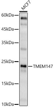Western blot analysis of extracts of mouse brain, using Anti-TMEM147 Antibody (A17076) at 1:500 dilution.
Secondary antibody: Goat Anti-Rabbit IgG (H+L) (HRP) (AS014) at 1:10,000 dilution.
Lysates / proteins: 25µg per lane.
Blocking buffer: 3% non-fat dry milk in TBST.
Detection: ECL Enhanced Kit (RM00021).
Exposure time: 300s.