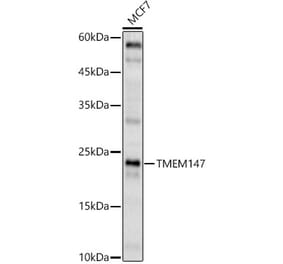 Western Blot - Anti-TMEM147 Antibody (A91765) - Antibodies.com