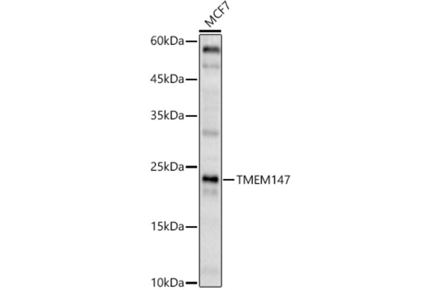 Western Blot - Anti-TMEM147 Antibody (A91765) - Antibodies.com
