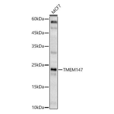 Western Blot - Anti-TMEM147 Antibody (A91765) - Antibodies.com