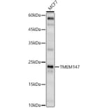 Western Blot - Anti-TMEM147 Antibody (A91765) - Antibodies.com