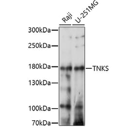 Western Blot - Anti-Tankyrase Antibody (A91766) - Antibodies.com