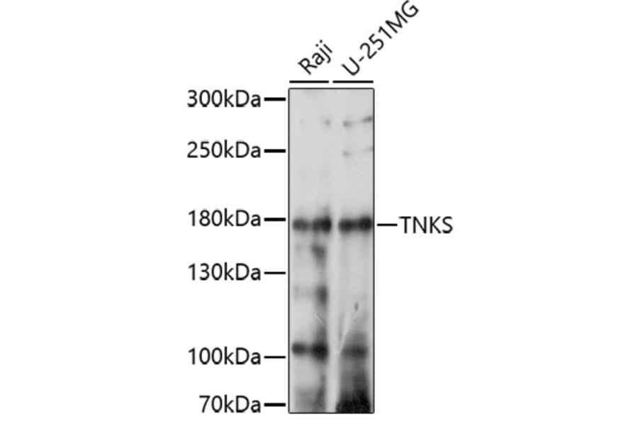Western Blot - Anti-Tankyrase Antibody (A91766) - Antibodies.com
