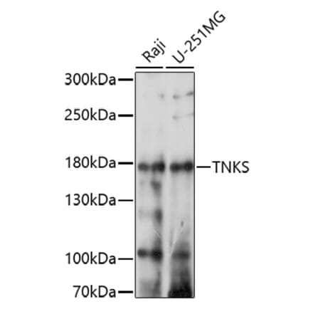 Western Blot - Anti-Tankyrase Antibody (A91766) - Antibodies.com