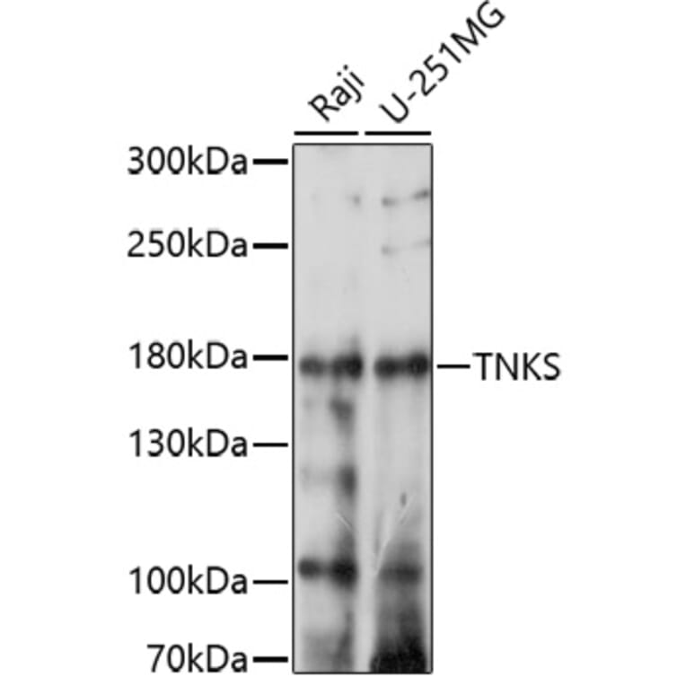 Western Blot - Anti-Tankyrase Antibody (A91766) - Antibodies.com