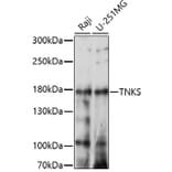 Western Blot - Anti-Tankyrase Antibody (A91766) - Antibodies.com