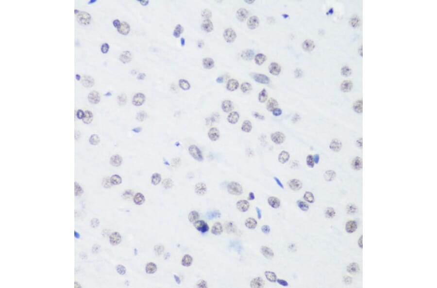 Immunohistochemistry - Anti-Histone H3 (tri methyl Lys64) Antibody (A91767) - Antibodies.com