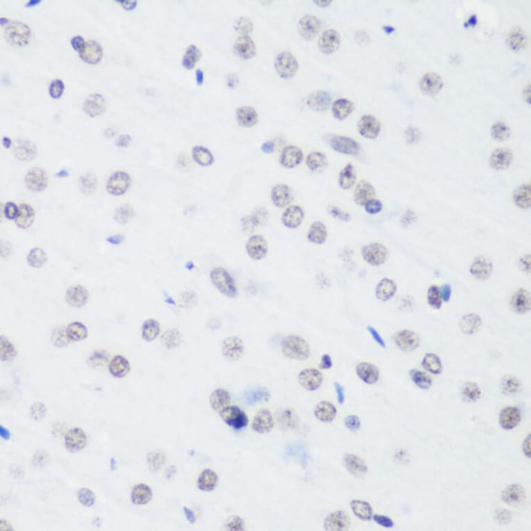 Immunohistochemistry - Anti-Histone H3 (tri methyl Lys64) Antibody (A91767) - Antibodies.com
