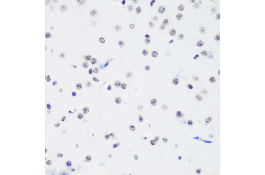 Immunohistochemistry - Anti-Histone H3 (tri methyl Lys64) Antibody (A91767) - Antibodies.com