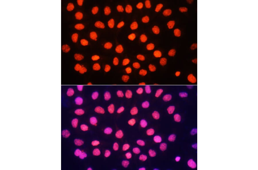 Immunofluorescence - Anti-Histone H3 (tri methyl Lys64) Antibody (A91767) - Antibodies.com