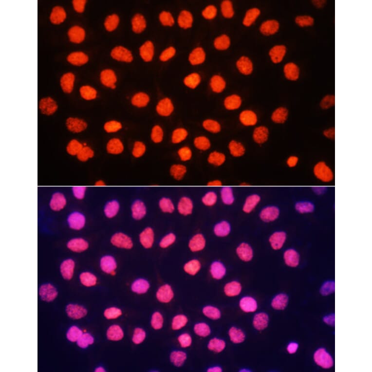 Immunofluorescence - Anti-Histone H3 (tri methyl Lys64) Antibody (A91767) - Antibodies.com