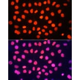 Immunofluorescence - Anti-Histone H3 (tri methyl Lys64) Antibody (A91767) - Antibodies.com